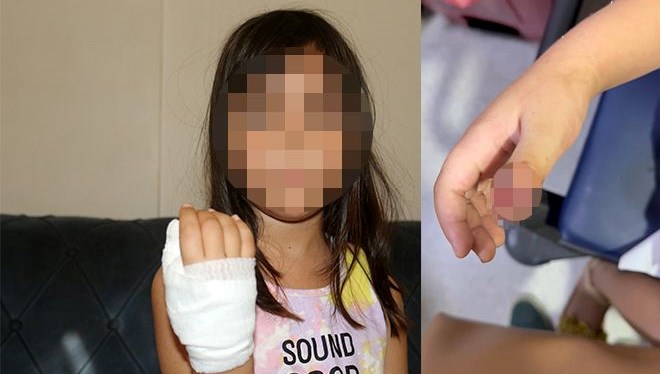 anaokulunda korkunc olay dort yasindaki cocugun parmagi koptu fZa1uAPZ